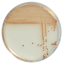 Chromogenic culture media for Campylobacter detection and enumeration