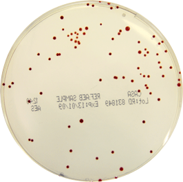 CASA, Chromogenic culture media for Campylobacter detection and enumeration